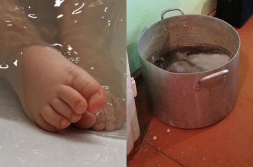 Yeddi aylıq uşaq qazanda boğuldu - FOTO