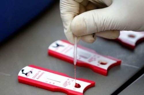 COVID-19-un ikinci dalğasının yayılacağı 10 ölkənin adı açıqlandı