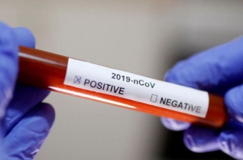 SON DƏQİQƏ: Klinikalar koronavirus testi müayinələrini dayandırdı-SƏBƏB