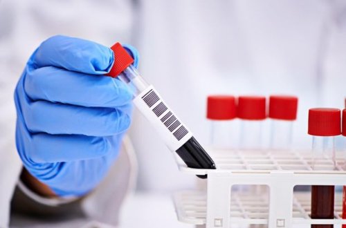 ANS-in tanınmış aparıcısının anası koronavirusdan öldü - FOTO