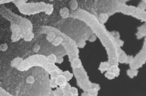 Koronavirus hüceyrəsinin yeni görüntüləri: Təcavüzkar və “zombi”