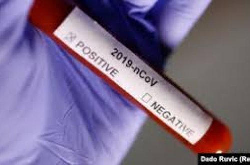 Названо число азербайджанских журналистов, заразившихся COVID-19