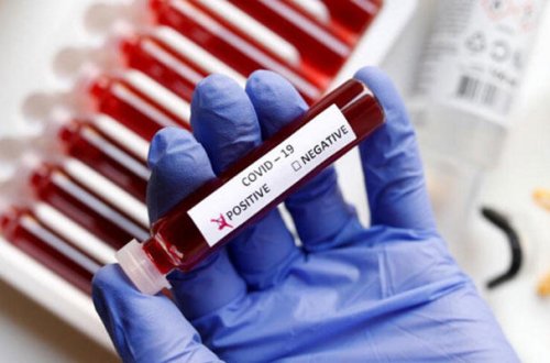 Daha 556 nəfərdə koronavirus aşkarlandı, 7 pasiyent öldü, 346 nəfər sağaldı