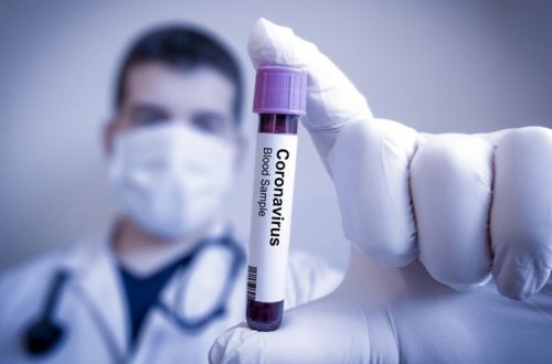 Boliviya Prezident Administrasiyasının rəhbəri koronavirusa yoluxdu