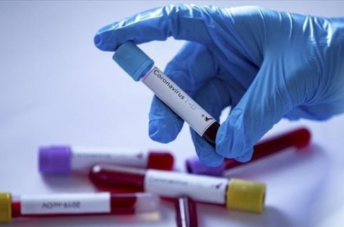 В России азербайджанский бизнесмен и его мать скончались от коронавируса