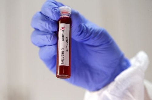 Azərbaycanda daha bir həkim koronavirusdan vəfat etdi - FOTO