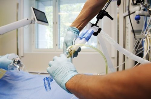 Süni tənəffüz cihazına qoşulan koronavirus xəstələrinin sayı bilindi