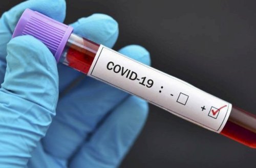 Bu ölkədə virusun “ikinci dalğası” başladı – 1 gündə 57 min yoluxma