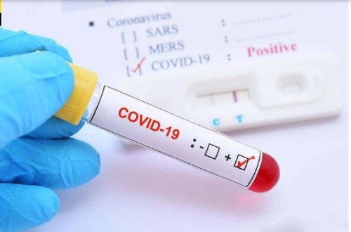 Bu əlamətlərdən biri varsa, təcili COVİD-19 analizi verin