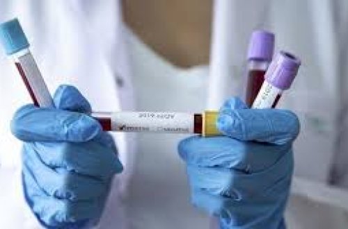 Hansı rayonda neçə koronavirus xəstəsi var?- SİYAHI