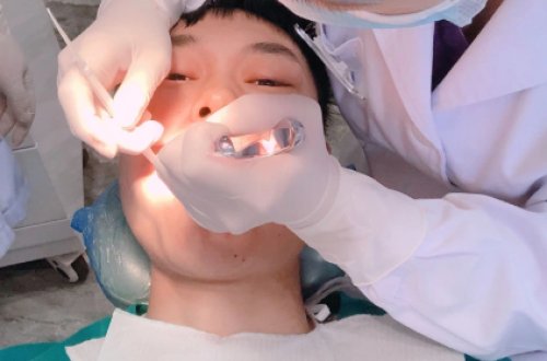 Ağıl dişini çıxartdılar - iki həftə sonra ÖLDÜ - FOTO