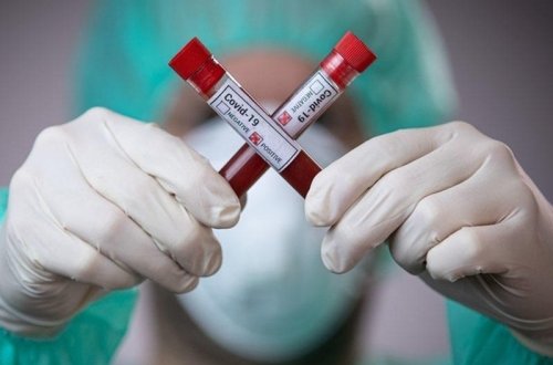 Pakistanda koronavirusa yoluxanların sayı 240 mini ötüb