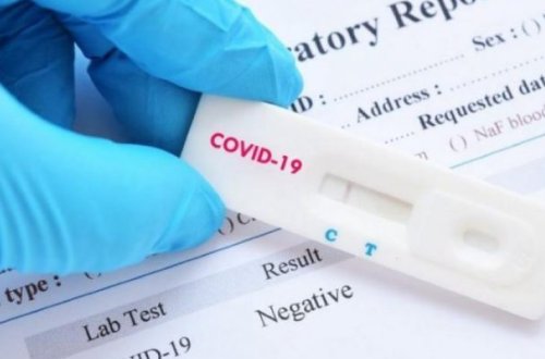 Azərbaycanda daha 526 nəfər koronavirusa yoluxdu, 8 nəfər vəfat etdi, 502 nəfər sağaldı