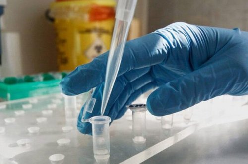 Son sutkada Pakistanda koronavirusdan 74 nəfər ölüb