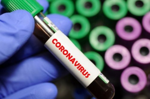 В Азербайджане еще один врач скончался от коронавируса - ФОТО