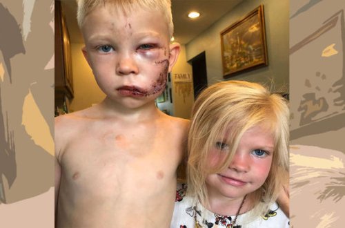 Altı yaşlı uşaq bacısını itdən qorumaq üçün özünü təhlükəyə atdı - FOTO