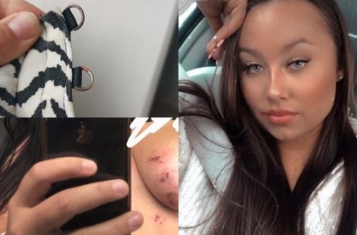 Sifariş verdiyi köynək sinəsində yanıq izləri qoydu - FOTO