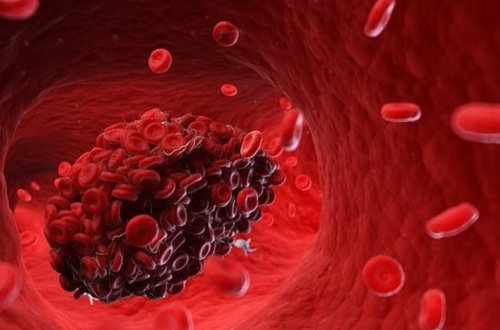 У всех умерших от коронавируса пациентов имелись тромбы