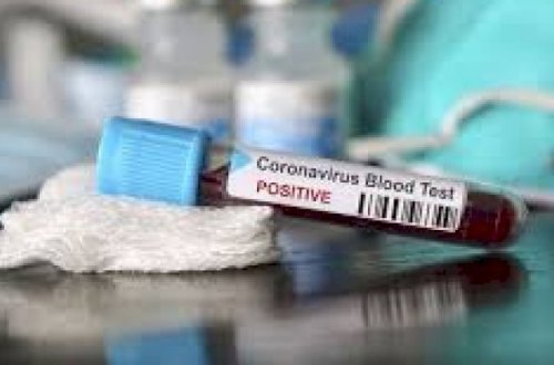 Ermənistanda koronavirusdan ölənlərin sayı 600-ü ötdü