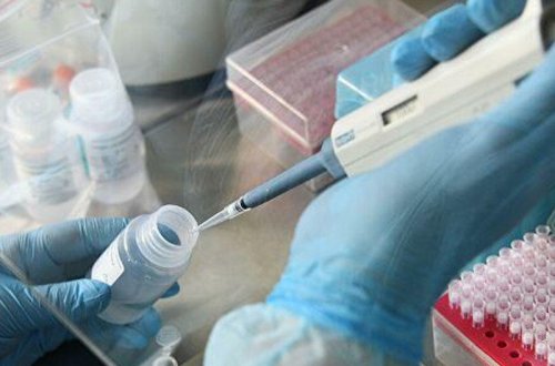 Qırğızıstanda son sutkada koronavirusdan 73 nəfər öldü, 70 tibb işçisi yoluxdu