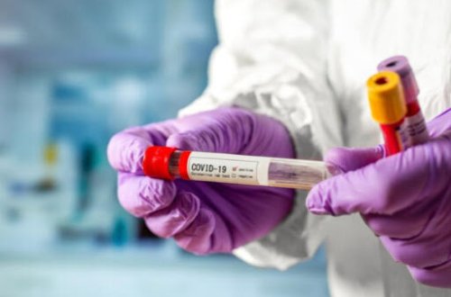 Azərbaycanda koronavirusla bağlı sevindirici xəbər - RƏSMİ