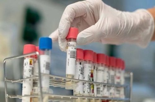 Число инфицированных коронавирусом в мире превысило 15 000 000