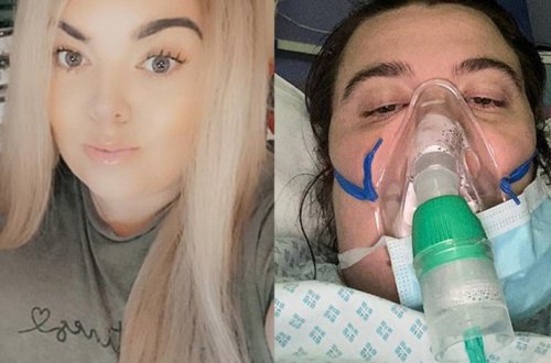 Теперь у меня залысины: переболевшие COVID-19 пожаловались на облысение – ФОТО