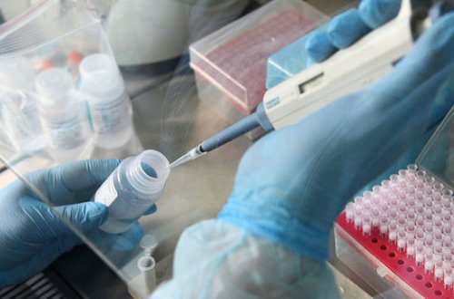 ÜST: “2021-ci ildən tez peyvənd olmayacaq”