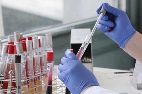 Azərbaycanda vəzifəli şəxs koronavirusun qurbanı oldu - FOTO