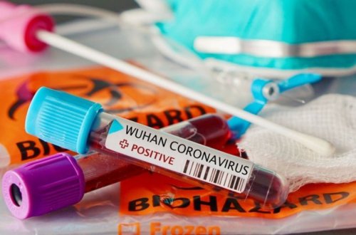 Koronavirusla mübarizənin təbii vasitəsini tapdılar - ŞAD XƏBƏR