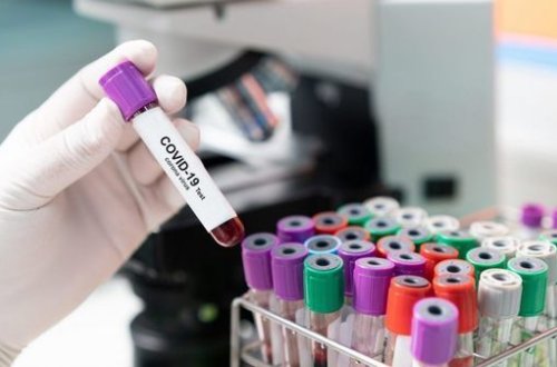 Число выздоровевших от коронавируса в мире превысило 10 000 000