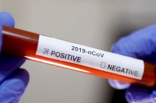 Koronavirusla bağlı yanlış göndərilən SMS-lərlə bağlı RƏSMİ AÇIQLAMA