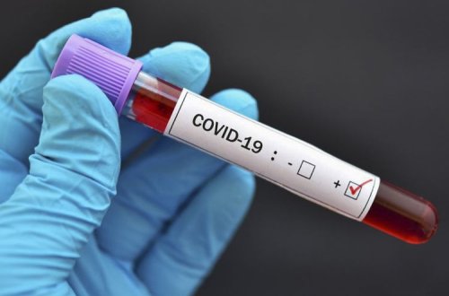 Özbəkistanda koronavirusa yoluxanların sayı 21,5 mini ötdü