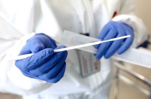 Турецкие врачи привлечены к лечению пациентов с коронавирусом в Азербайджане