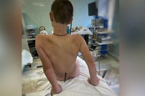 Qarmaq uşağın qarnından girib, belindən çıxdı - FOTO