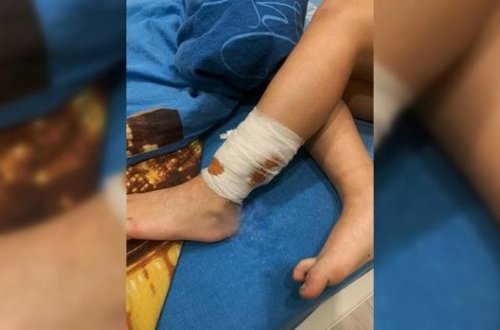 İt sürüsü hamilə qadına və azyaşlı oğluna hücum etdi