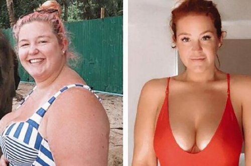 Ana olmaq istəyən qadın 77 kq arıqladı - FOTOLAR