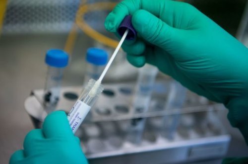 В Азербайджане выявлены 144 новых случая инфицирования COVID-19, скончались еще три человека - ФОТО