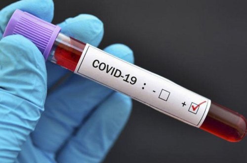 Hindistanda COVID-19-a yoluxanların sayı 2 milyonu ötüb