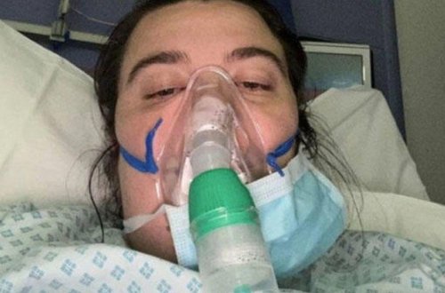 Koronavirusdan sağalan hər 4 nəfərdən 1-nin saçları sürətlə tökülür