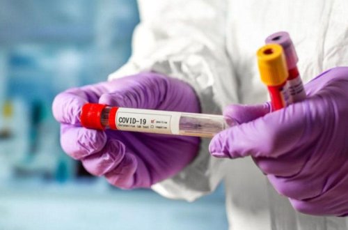 Azərbaycanda koronavirusa yoluxanların sayı ikirəqəmliyə düşdü, 2 nəfər öldü