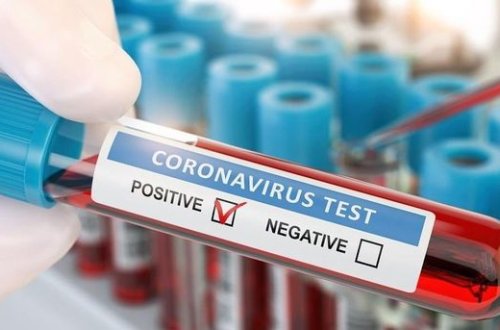 Dünyada koronavirusa yoluxanların sayı 20 milyonu keçdi - STATİSTİKA + VİDEO