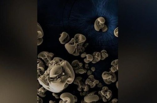 Metal yeyən bakteriya kəşf edildi