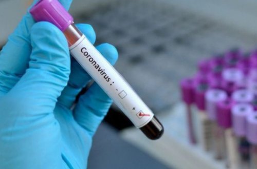 В Азербайджане наблюдается спад заболеваемости коронавирусом - ИНФОГРАФИКА