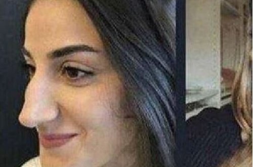 Bütün dünya bu qızın dəyişimindən danışır - FOTO