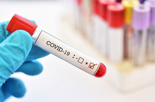 “Evdə müalicə alanlar 14 gün sonra avtomatik sağalmış sayılır” - Səhiyyə Nazirliyi