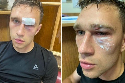 Millinin sabiq futbolçusu baş hakimi xəstəxanalıq etdi - VİDEO