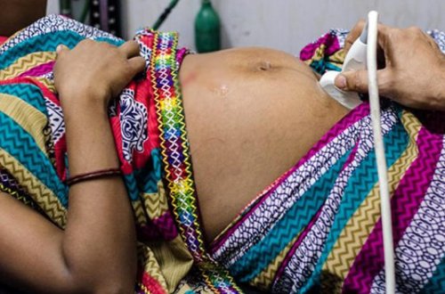 Hamilə qala bilmədiyi üçün həkimə gedən qadın 