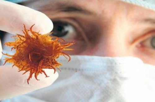 Xərçənglə mübarizə üsulu tapıldı - Yeni kəşf