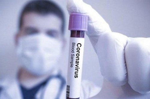 Azərbaycanda bu gün koronavirusdan heç kim ölməyib